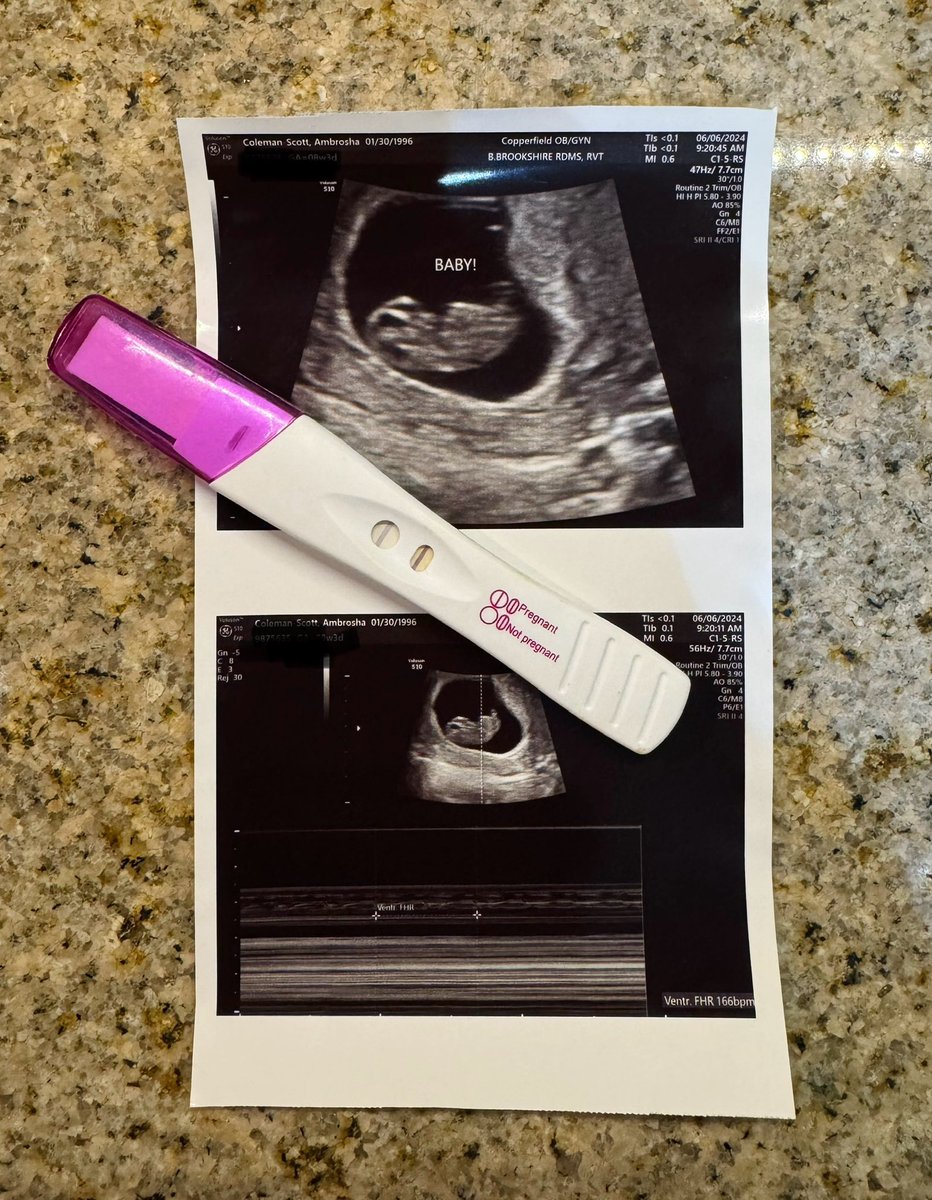 _Ambroshaaa's tweet photo. Twitter 🗣️
Update on my life: 
I’m about to be a mommy 🥹🫶🏽 https://t.co/pJvqDJxGbk