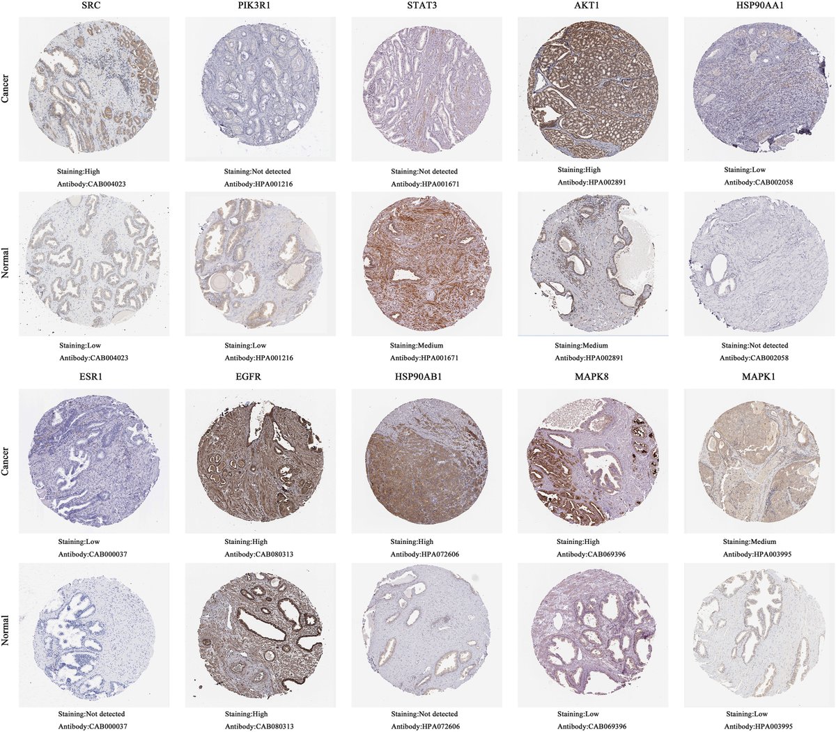 ProstateCell's tweet image. Researchers found 🔎 that #curcumin may have anticancer potential by upregulating the expression of PIK3R1 and STAT3, and downregulating the binding ability of molecules such as SRC, AKT1, HSP90AA1, ESR1, EGFR, HSP90AB1, MAPK8, and MAPK1. 

💡 Learn more: bit.ly/3XECgWA