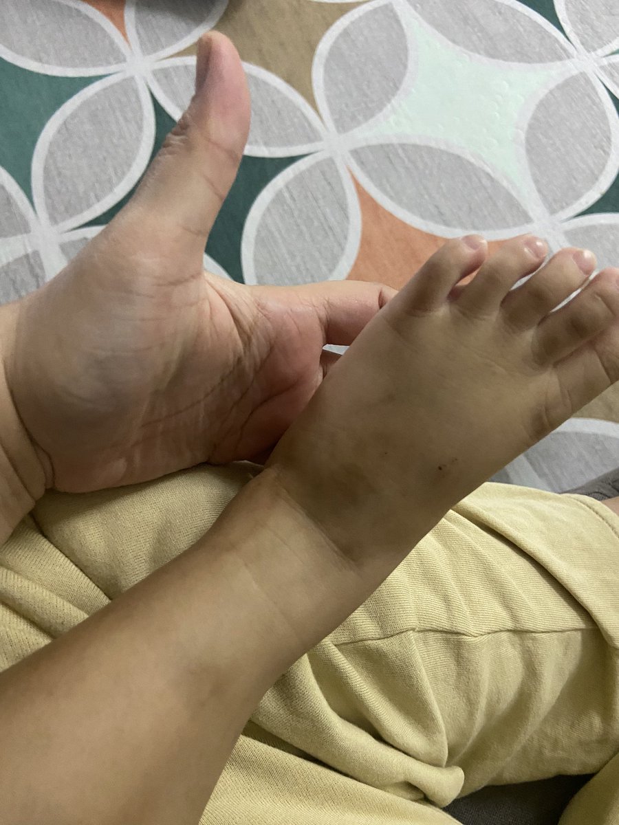 shaerasham's tweet photo. @indah_burn Pastu pastu tapak kaki comel dia tu linda. Buat lah cop ke gambar polaroid ke. Kita nyesal weh tak buat. Pejam celik dah macam kaki gajah dah ikut bapak kaki besau 🤣 https://t.co/vfRqnnrO9I