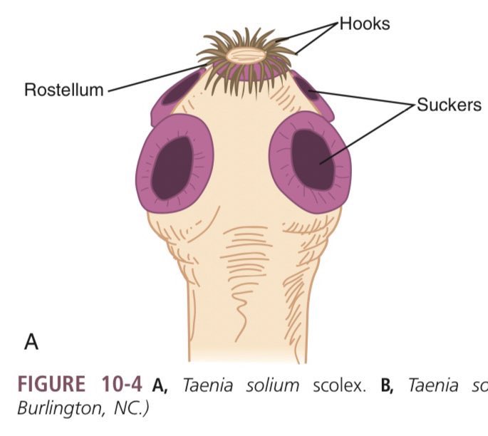 mjlbnotes's tweet image. Cestodes Mnemonics 🦠🧫

Without Hooks (unarmed): 𝘄𝗮𝗹𝗮𝗻𝗴 𝗦𝗔𝗡𝗗𝗔𝗧𝗔 (unarmed) 𝘀𝗶 𝗡𝗔𝗧𝗔 𝗮𝘁 𝗡𝗨𝗧𝗔
Taenia sagi𝗡𝗔𝗧𝗔
Hymenolepis dimi𝗡𝗨𝗧𝗔

With Hooks (armed): armed 🔫💣 = 𝗗𝗘a𝗧𝗛
𝗗ipyllidium caninum
𝗘chinococcus granulosus
𝗧aenia solium
𝗛. nana