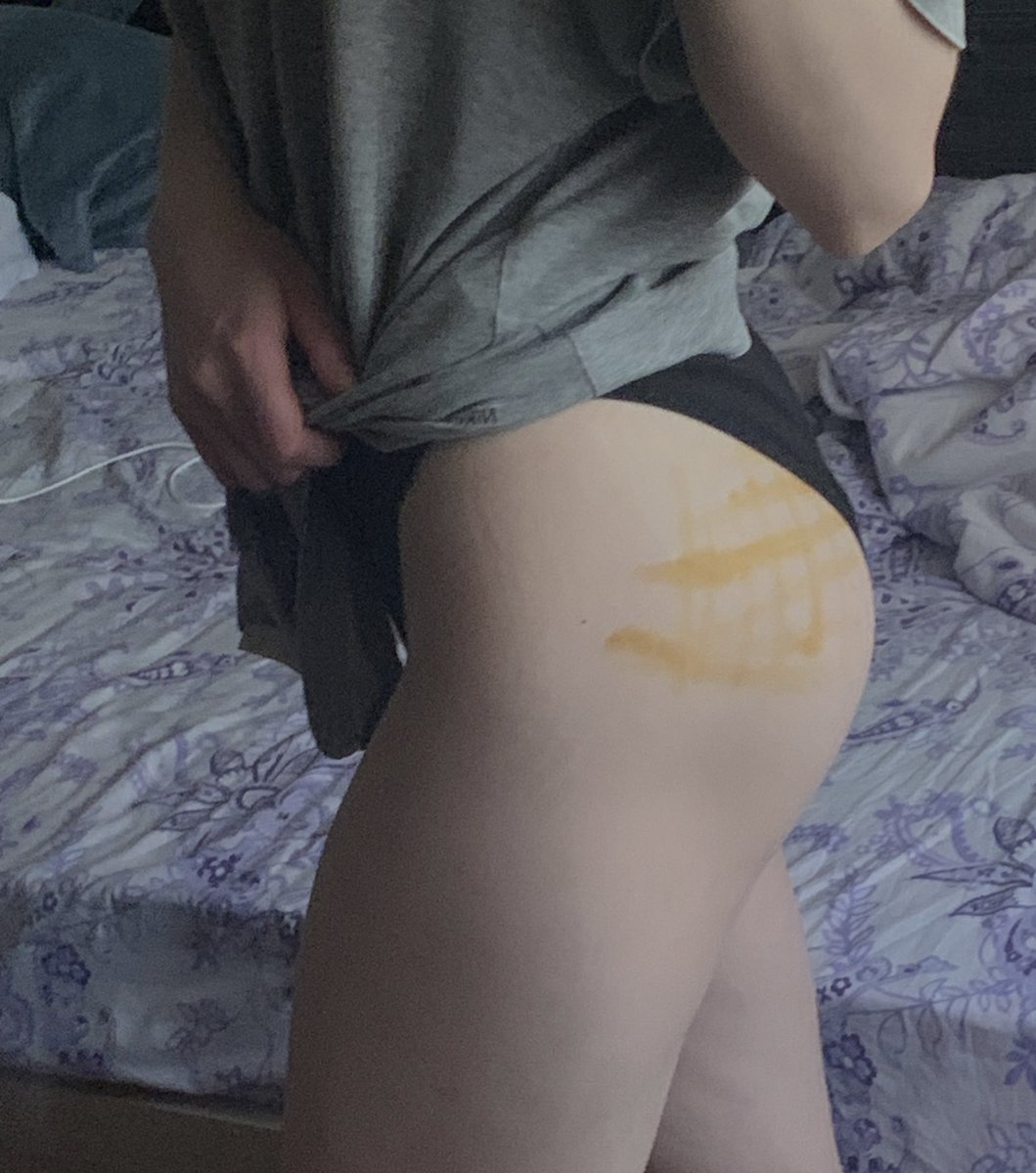 хожу так уже почти неделю... знали бы вы, как я ненавижу уколы и болеть
#нюдсочетверг