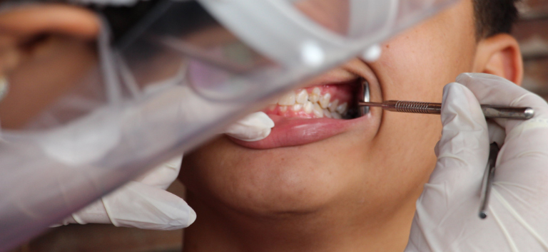 Secretada por #fungos, substância tem potencial para combater biofilme que causa #cárie dental. Resultado de estudo <a href="/fcfrp_usp/">FCFRP-USP</a>-<a href="/forpuspoficial/">FORP USP</a> é passo inicial para que enzimas produzidas pelo Trichoderma harzianum sejam usadas para degradar biofilmes orais agencia.fapesp.br/52064