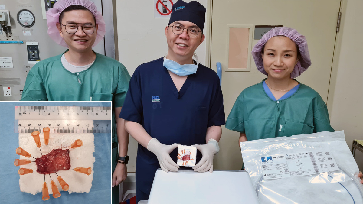CreoMedical's tweet photo. Congratulations to Dr Lau Peng Choong from Pantai Hospital, Kuala Lumpur who has become the first doctor in Malaysia 🇲🇾 to use the #SpeedboatUltraSlim! The oesophageal #SSD was performed this week, with further rollout of our latest Speedboat device across the country to follow. https://t.co/e3qBdwHhmB