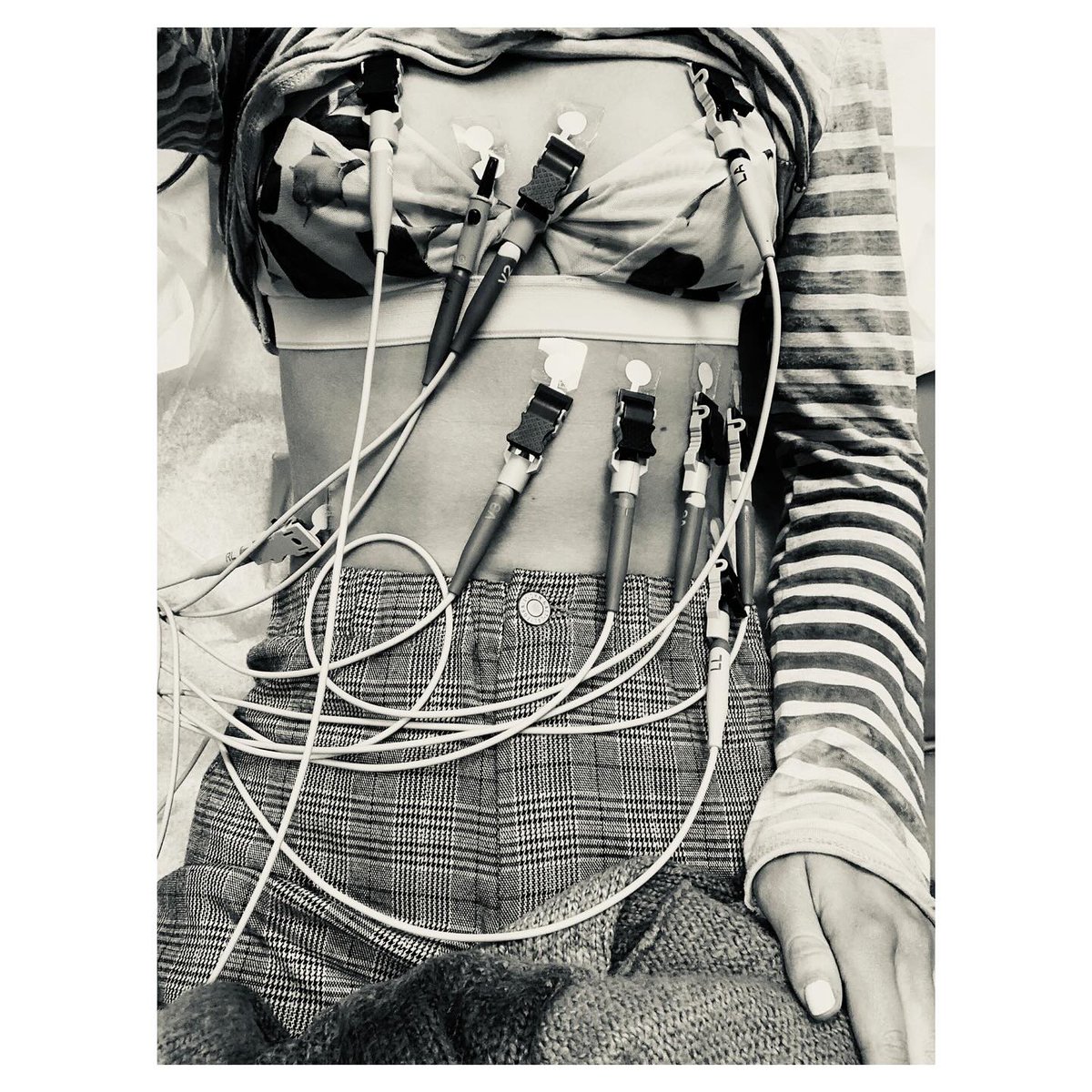 アメリカのマーゴ・ヘイズがライム病であることを告白しています。ライム病は野外活動中にマダニに咬まれることで感染し、発熱、筋肉痛、関節の腫れなどが生じ、脳や神経の機能不全に関する症状も出るそうです。13歳の時にレッド・リバー・ゴージュで感染したそうです

instagram.com/p/C8ccHmqpKs7/