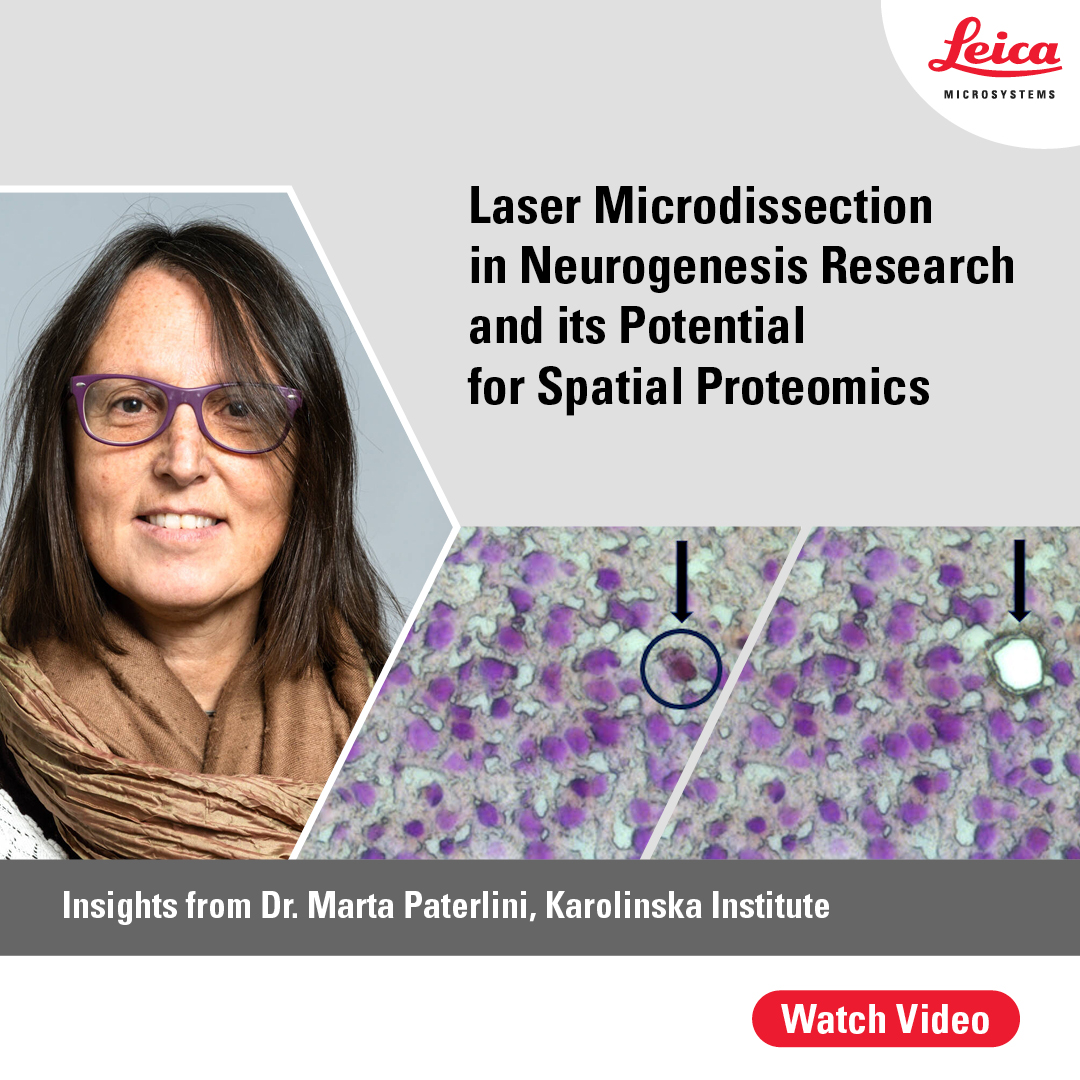LeicaMicro's tweet photo. Marta Paterlini from the @karolinskainst shares her experience using #laser #microdissection for breakthrough research into adult human #neurogenesis and personal insights into the exciting potential of LMD in #spatialproteomics and #precisionmedicine
👉 https://t.co/ZWUPRVC1JC https://t.co/Zqwm5es4Pf