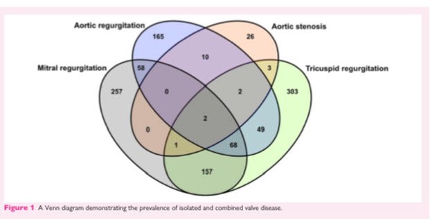 vass_vassiliou's tweet image. 1/2 How much asymptomatic & undiscovered valve disease is there?
A lot! 28% in fact.
See our latest work in #EHJ Imaging for our paper with #WIC @justvick
academic.oup.com/ehjcimaging/ad…
@mmamas1973 @DrMarthaGulati @purviparwani @AnastasiaSMihai @iamritu @Hragy @CMichaelGibson