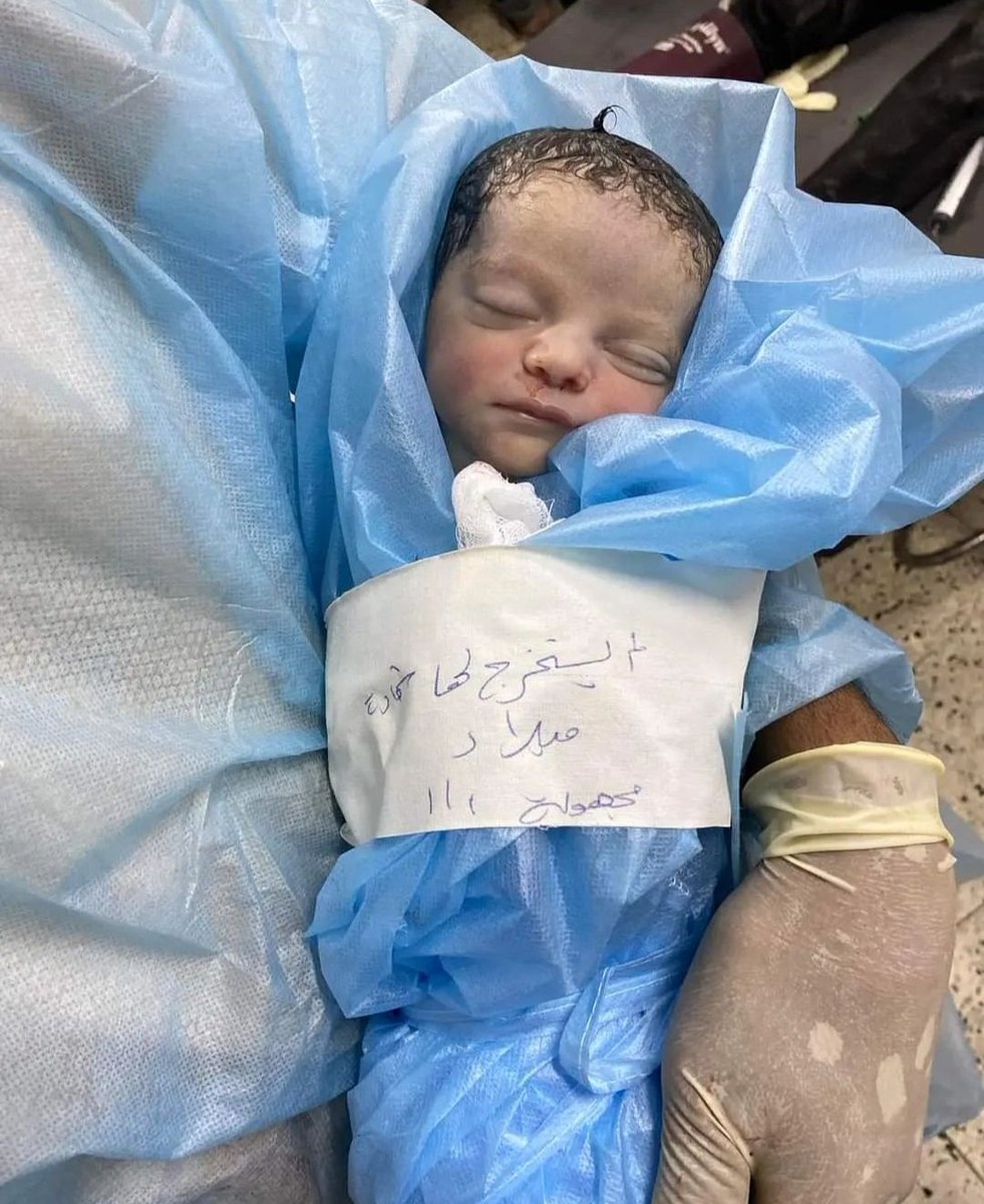 🔴 Gazze'de yenidoğan ve daha kimliği çıkarılmadan öldürülen bir bebek.

Kefeni üzerine "Kimliği bilinmiyor ancak onu kimin öldürdüğünü bütün dünya biliyor" yazıldı.