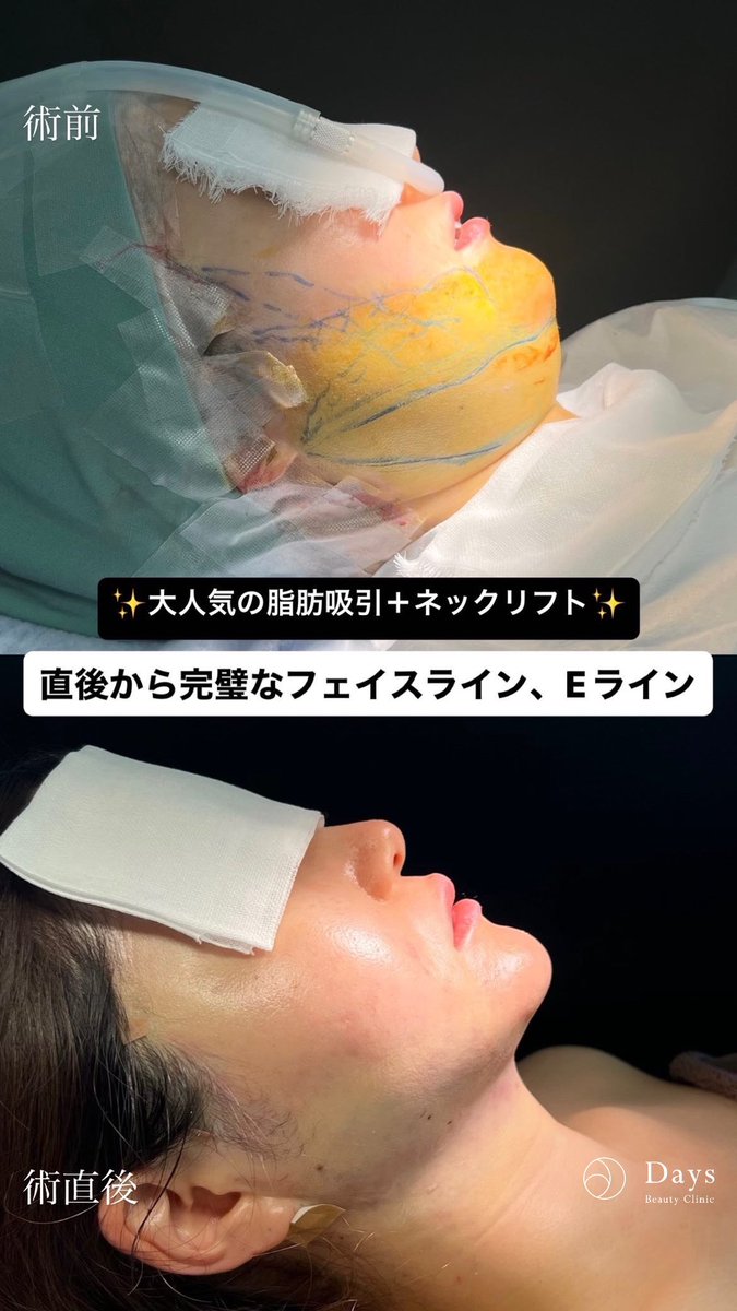 小顔整形 山野祐 tweet media