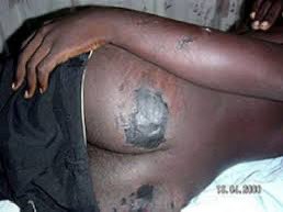 EricgonoJnr's tweet photo. In the run up to this day , 27 June 2008 , after @zanupf_patriots , @ZANUPF_Official had lost elections toTsvangirai, many citizens were killed. Until this day the regime in Harare has not reformed. They continue to use torture on citizens whose political views differ from theirs https://t.co/vlCgE4H8M5