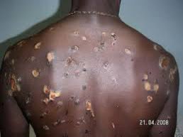 EricgonoJnr's tweet photo. In the run up to this day , 27 June 2008 , after @zanupf_patriots , @ZANUPF_Official had lost elections toTsvangirai, many citizens were killed. Until this day the regime in Harare has not reformed. They continue to use torture on citizens whose political views differ from theirs https://t.co/vlCgE4H8M5