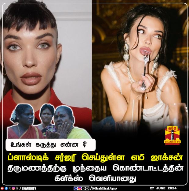ThanthiTV's tweet photo. ப்ளாஸ்டிக் சர்ஜரி செய்துள்ள எமி ஜாக்சன் 
திருமணத்திற்கு முந்தைய கொண்டாட்டத்தின் கிளிக்ஸ் வெளியானது
உங்கள் கருத்து என்ன ?
#Thanthitv #emyjackson #plasticsurgery https://t.co/g2nvNgLtxF
