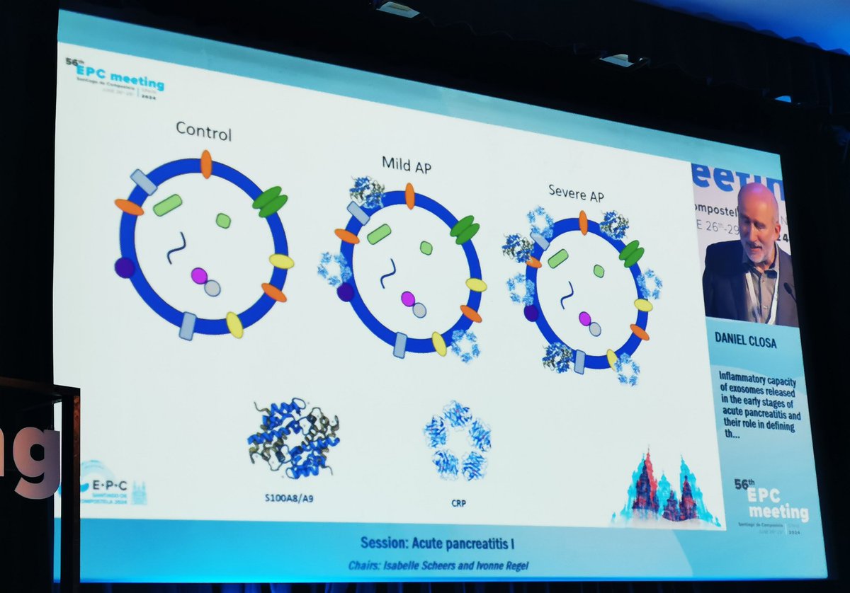Inflammatory capacity of exosomes released in the early stages of acute pancreatitis and their role in defining the severity of the disease.🙌👏
<a href="/nielo40/">Daniel Closa</a>
<a href="/EurPancClub/">EPC-Europ Pancr Club</a>
#EPC2024