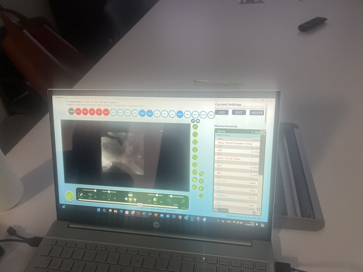 Dr Mari Viviers (@viviers_mari) on Twitter photo Great day at <a href="/imperialcollege/">Imperial College London</a> discussing all things SwallowTail VFSS analysis for Analou’s PhD ……great to finally meet Dr Anna Miles face2face all the way from New Zealand <a href="/AnalouSugar/">Analou Sugar</a> <a href="/annacmiles/">Anna Miles</a> #ClinicalAcademicResearchers #PaediatricDysphagia <a href="/CMarthaAlex/">Caroline Alexander</a> <a href="/ImperialPeople/">Imperial People 💙</a> Great day at <a href="/imperialcollege/">Imperial College London</a> discussing all things SwallowTail VFSS analysis for Analou’s PhD ……great to finally meet Dr Anna Miles face2face all the way from New Zealand <a href="/AnalouSugar/">Analou Sugar</a> <a href="/annacmiles/">Anna Miles</a> #ClinicalAcademicResearchers #PaediatricDysphagia <a href="/CMarthaAlex/">Caroline Alexander</a> <a href="/ImperialPeople/">Imperial People 💙</a>
