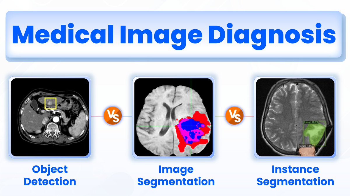 OpenCVUniverse's tweet photo. See how object detection, image segmentation, and instance segmentation can help in diagnostics.
https://t.co/bjWv5cnnii
#MedicalImaging #HealthcareTech #ObjectDetection #ImageSegmentation #InstanceSegmentation #AIMedicine #HealthInnovation #MedicalTechnology #Diagnostics #TechHealth