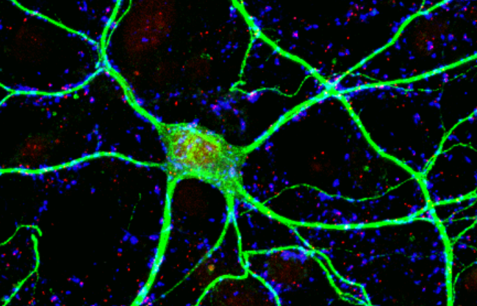 BMCBiology's tweet photo. New #openaccess #research from @fjbustosf and co. finds a role for VPS50 in #synaptic function and #behaviour  in mammals involving synaptic vesicle acidification. https://t.co/RdJOy2blq3  #Synapse #crispr #autism #hippocampus #memory #NeuralPlasticity https://t.co/bMQIPj4CVm