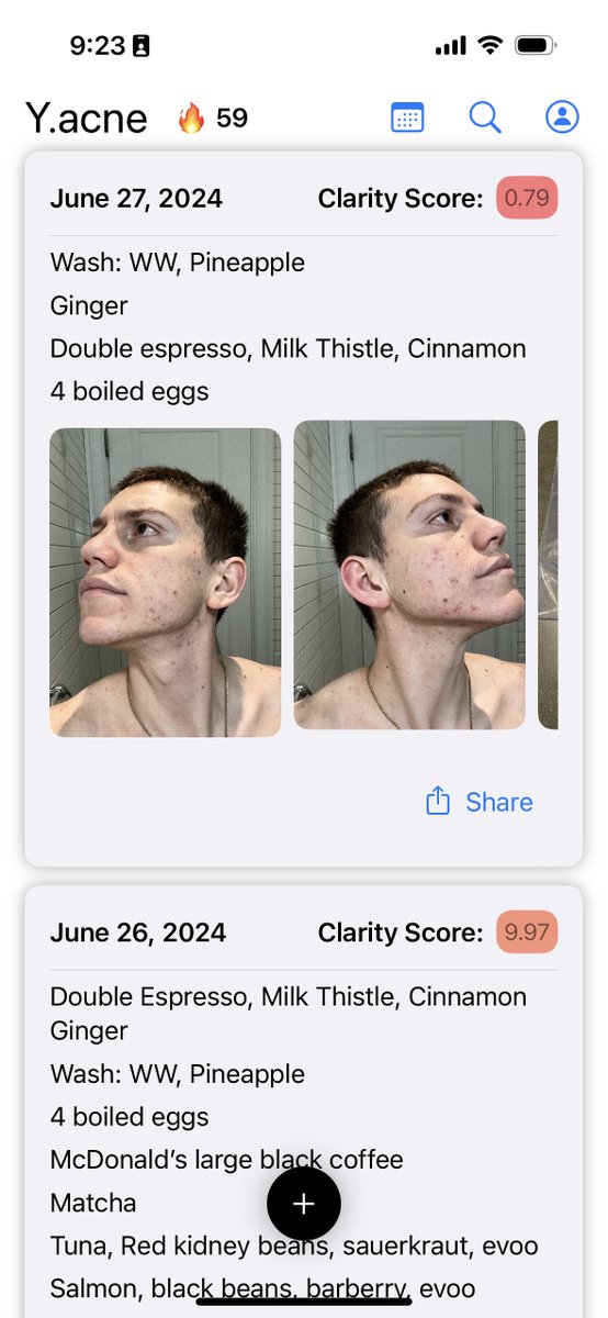 AcneHub's tweet image. Clear your acne by journaling  

I built an app to streamline this process. Check it out!

testflight.apple.com/join/JpuyhuWh

CC: @_nightsweekends @_buildspace