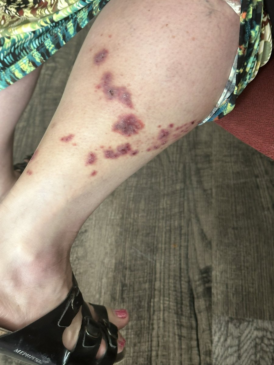 Beth Steckler (she/her) tweet media