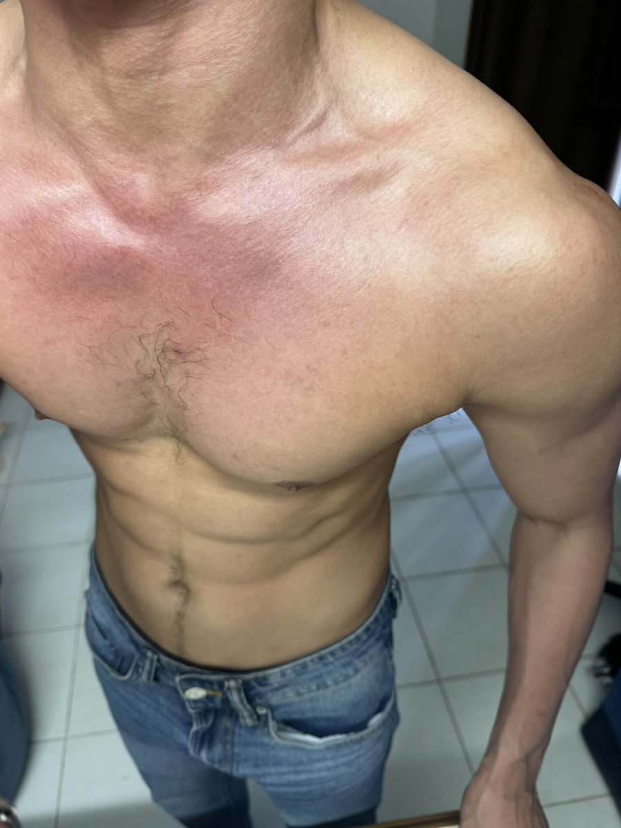 คืนนี้ผมว่างอยู่นะครับผม💦
#หาดใหญ่รับงาน #หาดใหญ่ญ่สงขลา #หาดใหญ่นัดเจอ #สงขลารับงาน #หาดใหญ่เงี่ยน #รับงานสงขลา