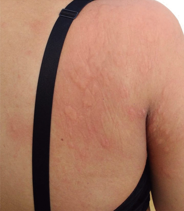 They Keep Saying Its Rare tweet media