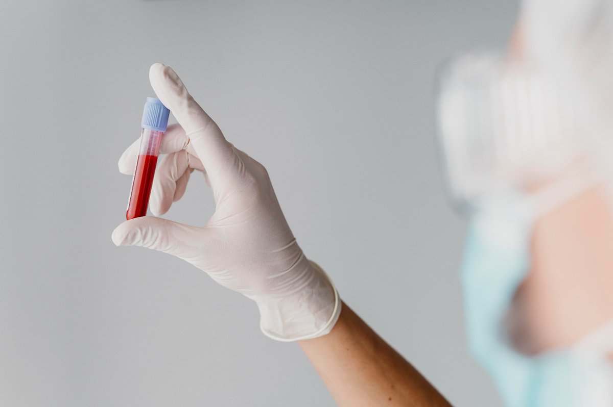 RobertoMat95713's tweet photo. ALERTA: PAÍS REGISTRA AUMENTO DE 168% NOS CASOS DE HIV ENTRE OS JOVENS. Dados divulgados pelo ministério da saúde referem-se aos últimos dez anos e reforçam a importância do uso de preservativos. O número é considerado alarmante. Saiba mais. Acesse: https://t.co/8Jwx7X09M6 https://t.co/e8tfXaiE97