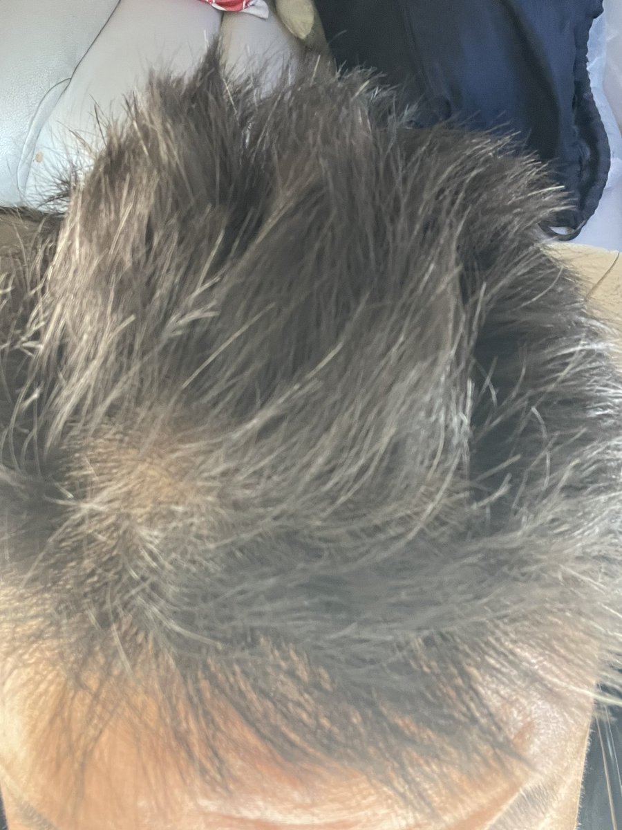 娃放假了，夫妻团聚去了
头发都白了😭