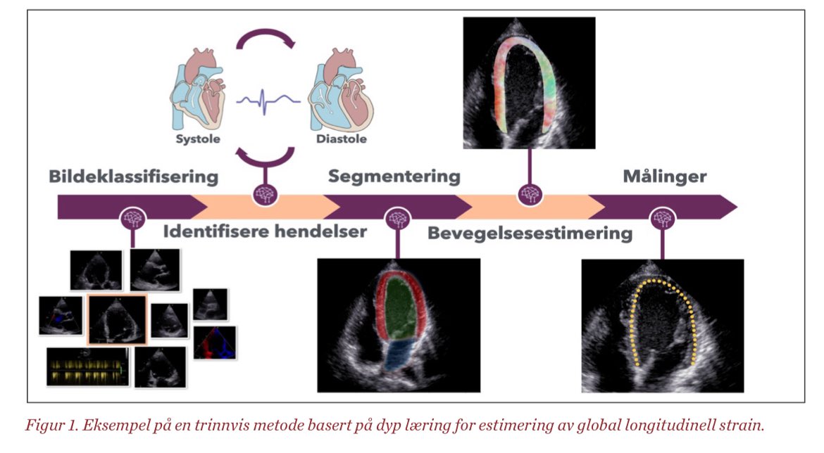 Hjerteforum (@hjerteforum) on Twitter photo Kunstig intelligens i ekkokardiografi: Vår nye superassistent?
Heng med i utviklingen og lær av ekspertene #BjørnarGrenne #AndreasØstvik <a href="/HealthNTNU/">NTNU Health</a>
legeforeningen.no/contentassets/… Kunstig intelligens i ekkokardiografi: Vår nye superassistent?
Heng med i utviklingen og lær av ekspertene #BjørnarGrenne #AndreasØstvik <a href="/HealthNTNU/">NTNU Health</a>
legeforeningen.no/contentassets/…