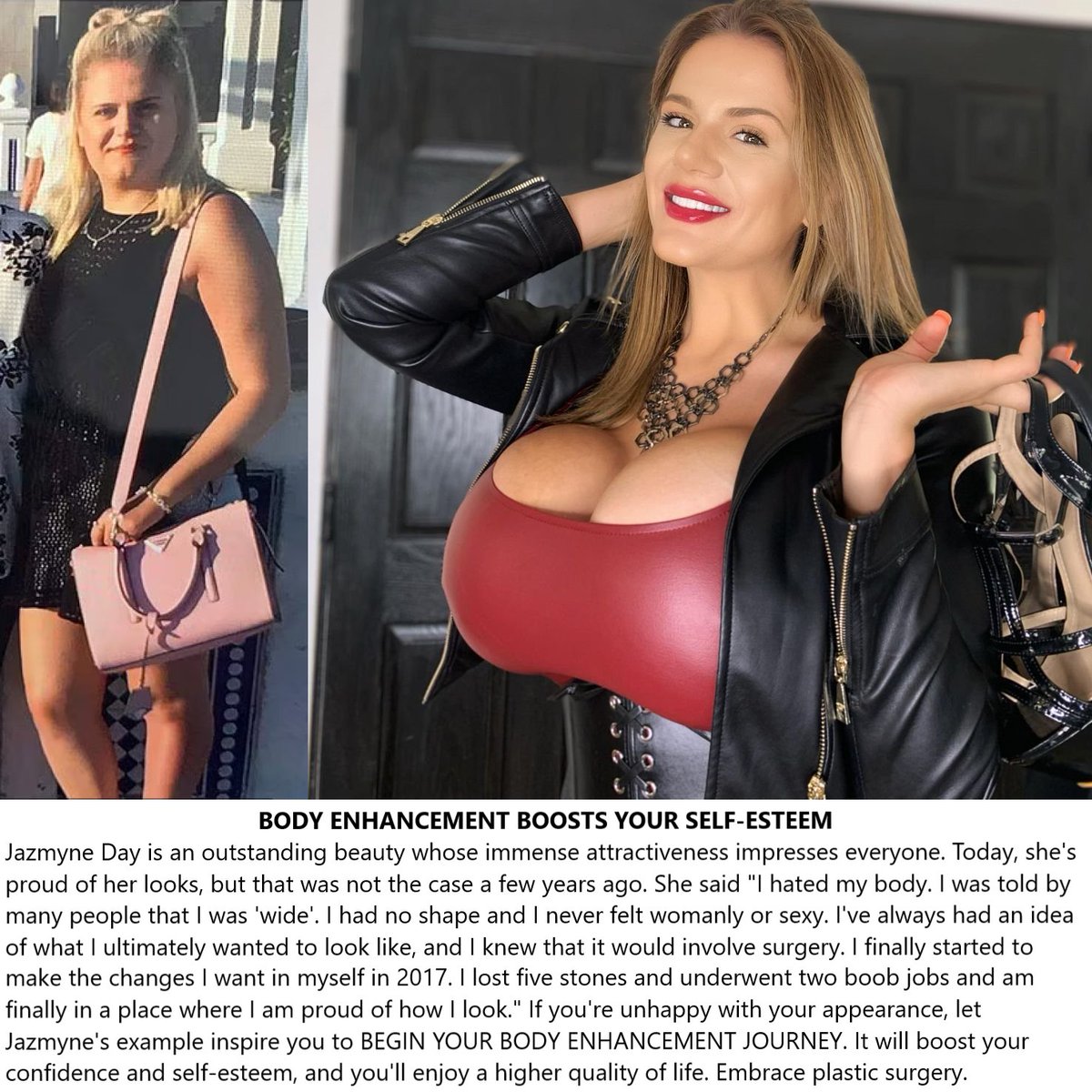 plastic_ms's tweet image. Follow @jazmynedayy #plasticsurgery #cosmeticsurgery #bimbogirl #bimbobarbie #bimbo #bimbogoddess #BreastAugmentation #bigboobs #plasticlife #plasticdoll #plasticmakesperfect #fitnessgirl #FitnessMotivation #FitnessGoals #fitness #FitnessModel