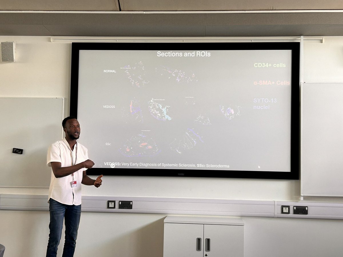 NTU Metabolic Health (@ntu_metabolism) on Twitter photo A fascinating PhD study using spatial transcriptomics! presented at our theme meeting, Well done Emmanuel! Supervised by <a href="/yassersherbiny/">Yasser El-Sherbiny</a> and <a href="/LabRutella/">Rutella Lab</a>
<a href="/NTU_Metabolism/">NTU Metabolic Health</a> <a href="/NTUSciTech/">NTUScienceTechnology</a> <a href="/NTUBIOSCIENCES/">Dept of Biosciences, Nottingham Trent University</a> <a href="/NTUDoctoral/">NTU Doctoral School</a> A fascinating PhD study using spatial transcriptomics! presented at our theme meeting, Well done Emmanuel! Supervised by <a href="/yassersherbiny/">Yasser El-Sherbiny</a> and <a href="/LabRutella/">Rutella Lab</a>
<a href="/NTU_Metabolism/">NTU Metabolic Health</a> <a href="/NTUSciTech/">NTUScienceTechnology</a> <a href="/NTUBIOSCIENCES/">Dept of Biosciences, Nottingham Trent University</a> <a href="/NTUDoctoral/">NTU Doctoral School</a>