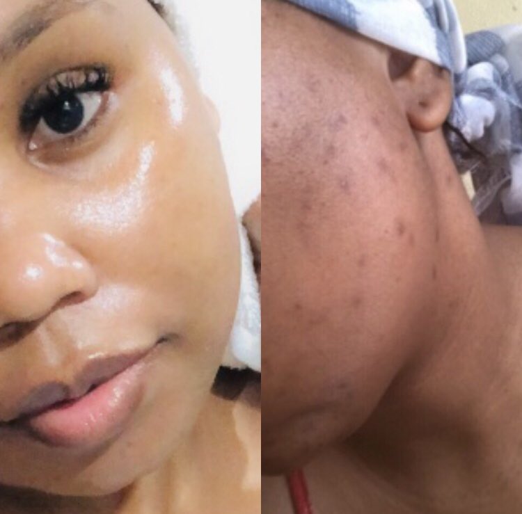 milliy_0601's tweet photo. Never stop trying to find what works for your skin..and when you find it-stick to it.

(Sunscreen meets vitamin c is an all star in my books💫)  and in winter? hydration is key🙌🏾 https://t.co/RmysiF9nra