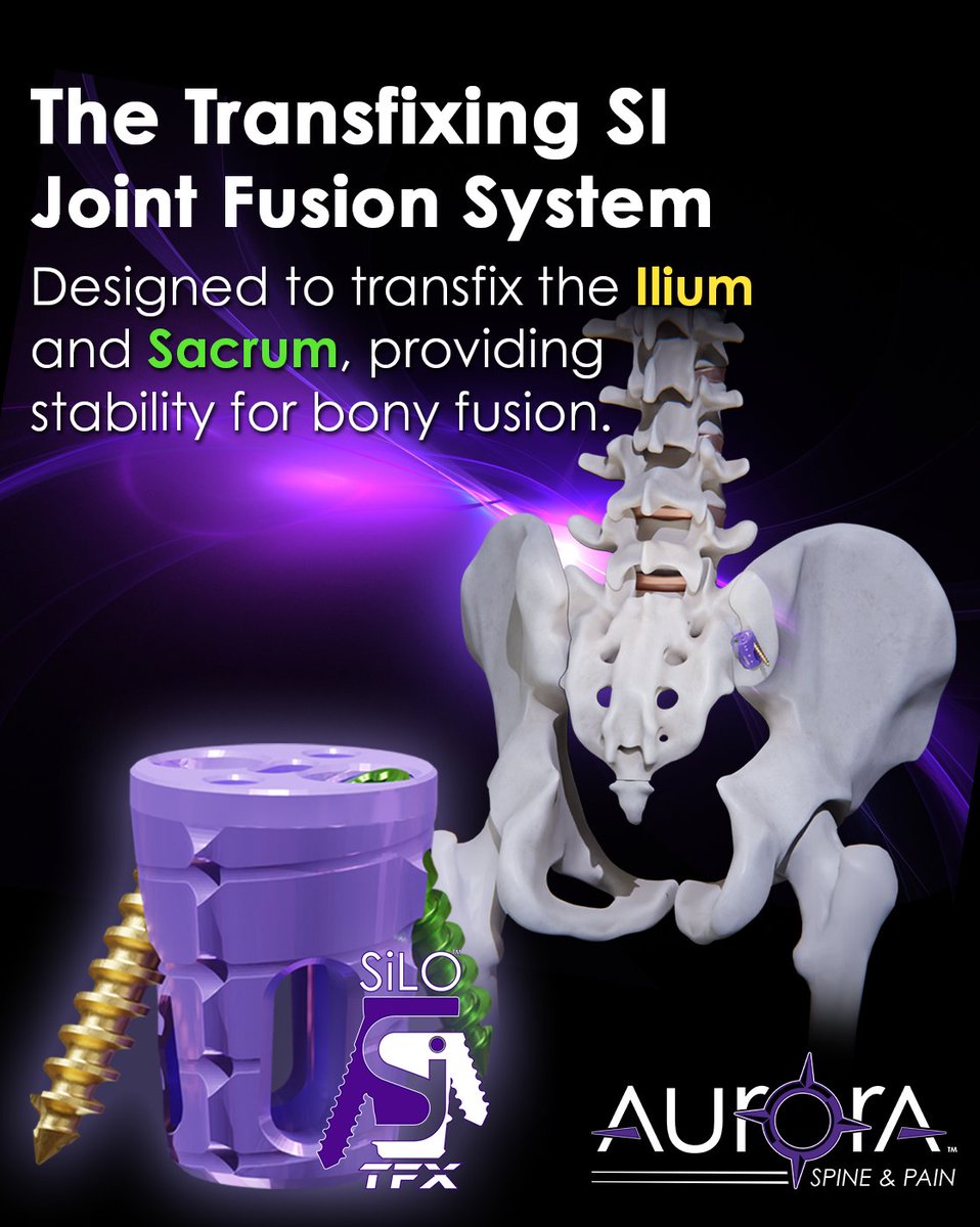 AuroraSpine's tweet photo. #TFXThursday | Crafted from a robust titanium alloy, it includes two holes used to transfix screws through the Sacrum and the Ilium, ensuring stability.
#SiLOTFX #Transfixingthesijoint #sijointpain #sijointdysfunction #TFX79 https://t.co/sbQrE1aZlz