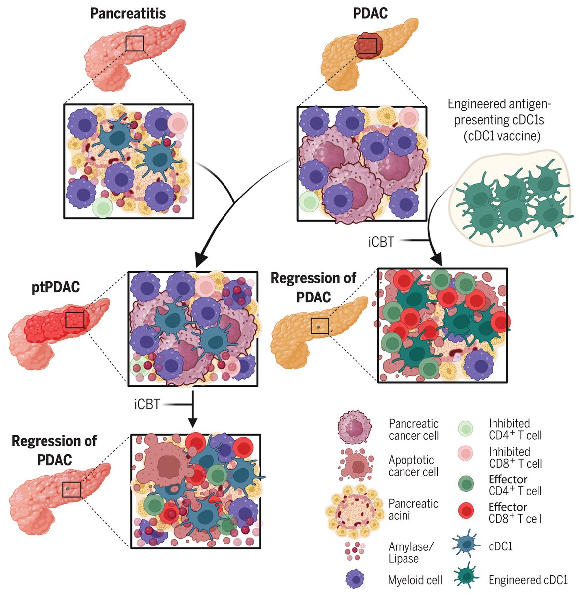 Waggoner Lab (@labwaggoner) on Twitter photo Type I conventional DCs facilitate immunotherapy in pancreatic cancer <a href="/ScienceMagazine/">Science Magazine</a>
science.org/doi/10.1126/sc… Type I conventional DCs facilitate immunotherapy in pancreatic cancer <a href="/ScienceMagazine/">Science Magazine</a>
science.org/doi/10.1126/sc…