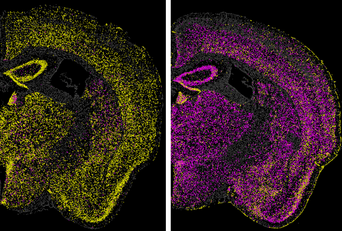 Broad Institute (@broadinstitute) on Twitter photo Scientists at <a href="/WhiteheadInst/">Whitehead Institute</a> and Broad have developed a gene-silencing tool to potentially treat fatal prion diseases by turning off the disease-causing gene. A promising step towards gene therapy for diseases that lack treatments. broad.io/CHARM-news Scientists at <a href="/WhiteheadInst/">Whitehead Institute</a> and Broad have developed a gene-silencing tool to potentially treat fatal prion diseases by turning off the disease-causing gene. A promising step towards gene therapy for diseases that lack treatments. broad.io/CHARM-news