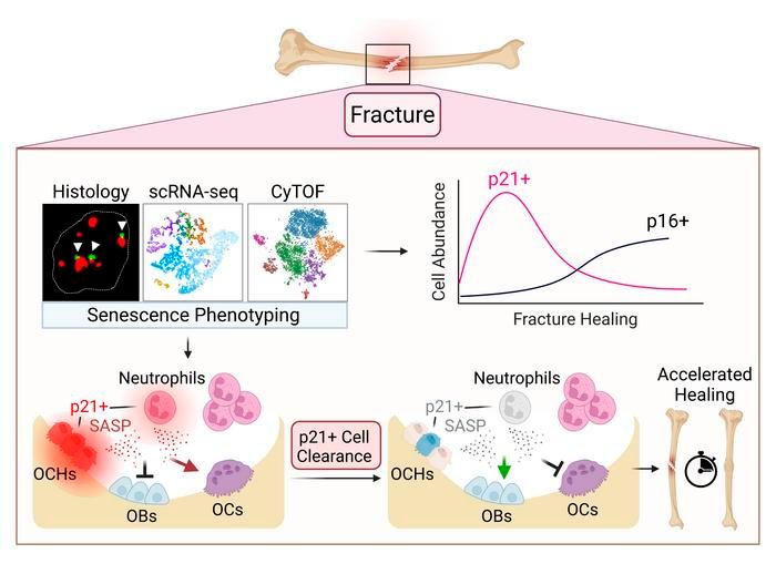 jclinicalinvest's tweet photo. Osteochondroprogenitor cells and neutrophils expressing p21 and senescence markers modulate fracture repair: https://t.co/qb9I8Z3DjR 

@MadisonDoolitt3 @skhosla78 @MayoClinic 
#Aging #BoneBiology https://t.co/nvlDbUkFom