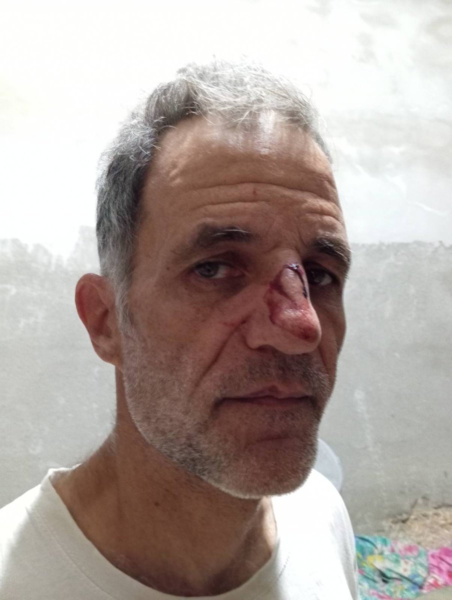 הערב הותקף פעיל סולידריות  הכפר ג'אוואיה על ידי שלושה מתנחלים מהמאחז חוות מן של המתנחל יששכר מן, שביצעו את התקיפה בעודם מלווים על ידי חיילים. 
הפעיל  שהיה בדרכו לליווי רועים הוכה בפניו ובצלעות ומתפנה ברגעים אלו לבית חולים