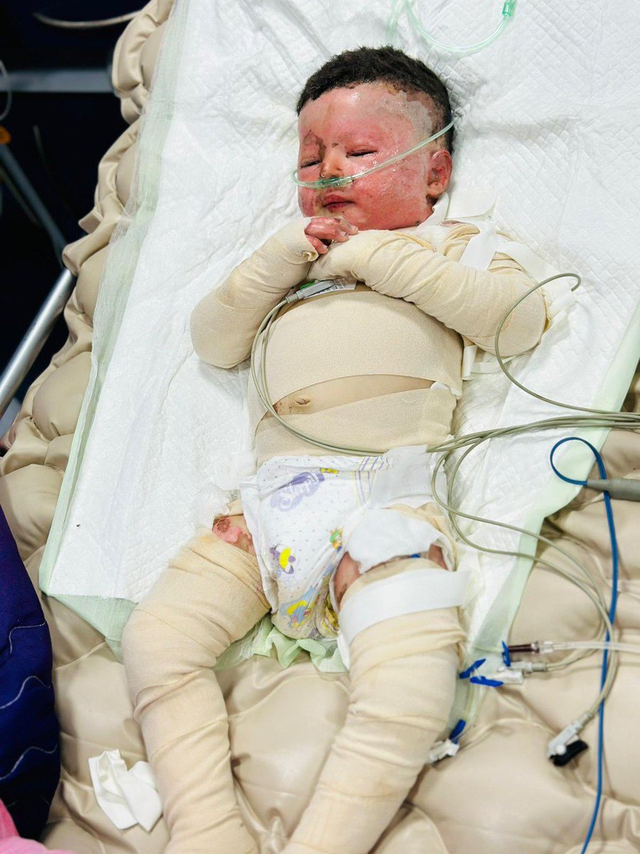 Timesofgaza's tweet image. Day 262 | During the past 24 hours:

• 3 massacres committed by the Israeli occupation

• 47 people killed 

• 52 injured