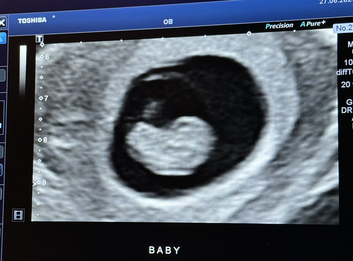 Ordinary Adam tweet media