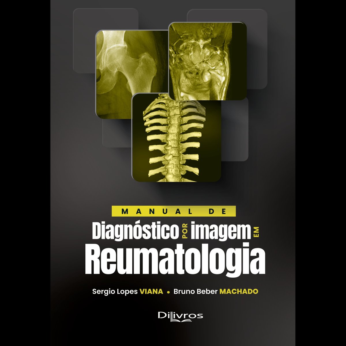 🇧🇷 Saiu a capa de nosso "Manual de Diagnóstico por Imagem em Reumatologia", nova versão de um livro clássico que continua o único a abordar este tema em português, desta vez com a colaboração de colegas do primeiro time da radiologia MSK brasileira.Setembro é logo ali, até o CBR!
