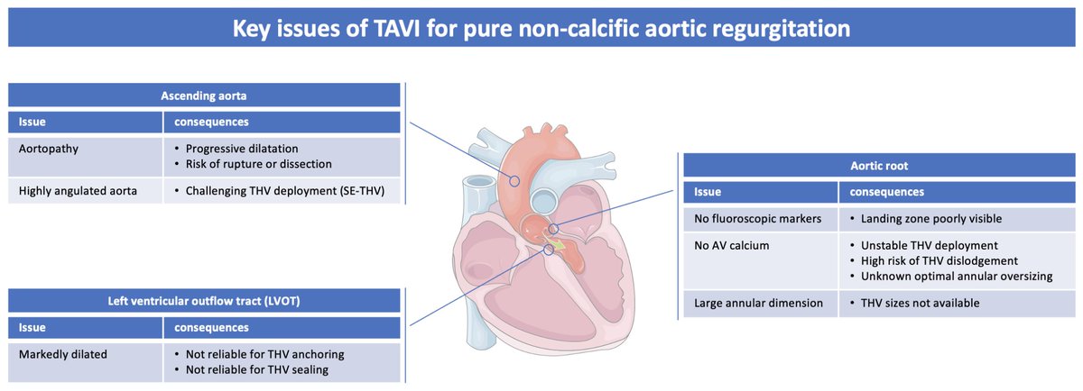 barbanti_marco's tweet photo. TAVI for pure aortic regurgitation: current status and future directions. A clinical outlook on one of the most captivating new indications. #TAVR #TAVI #aorticregurgitation #pureAR @SpringerNature @NatRevCardiol @drmaisano https://t.co/ireMUs3omG