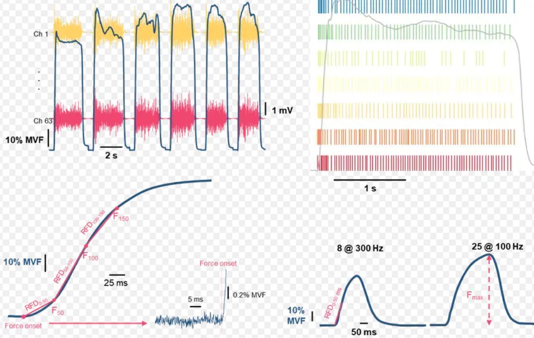 ISEKCongress's tweet photo. #OralAwardSession #ISEK2024
Is there a difference in motor unit activity and muscle contractile properties between long-term resistance-trained &amp; endurance-trained athletes during the performance of rapid contractions? 
To find out, come along for the presentation by @hthomason14 https://t.co/mePOoOpxmr