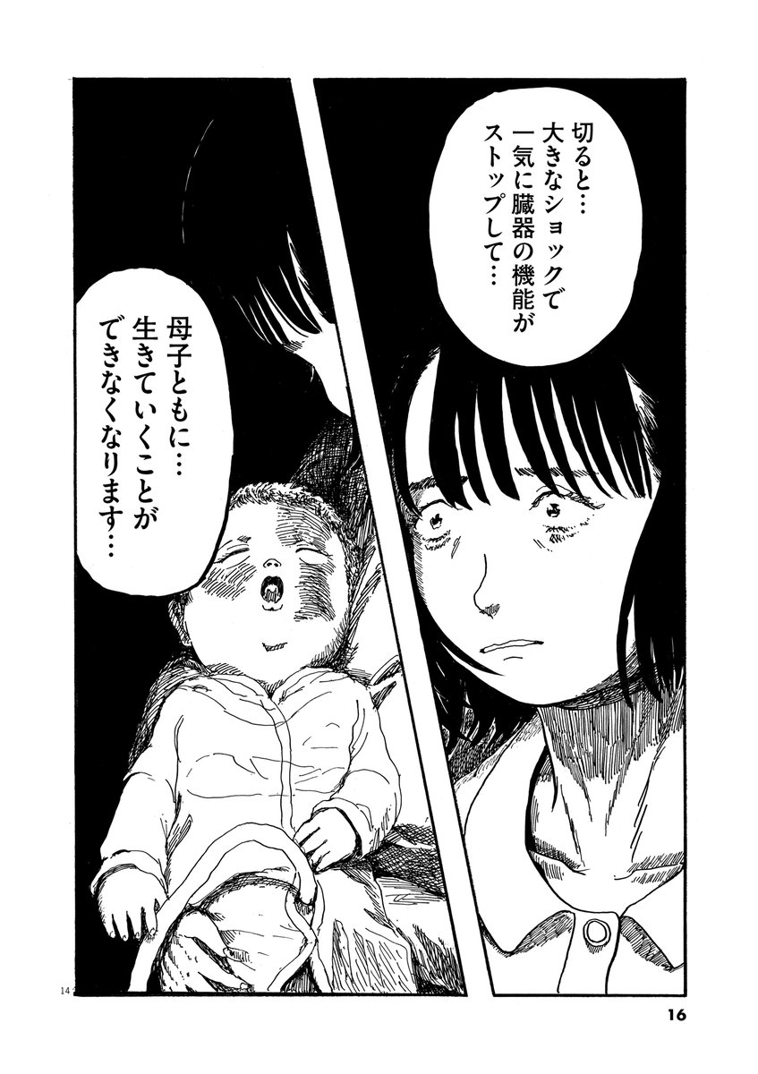 へそのおを切ったら死んでしまう母子の話(4/10) 