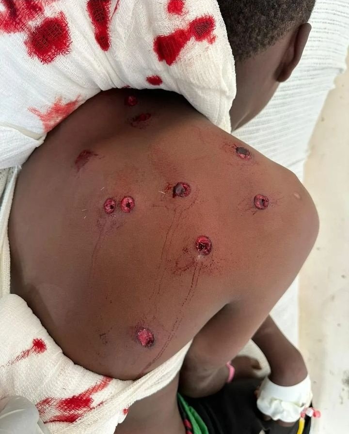 syntaxartstudio's tweet photo. ⚠️No trigger warning ⚠️
The TRUTH remains the TRUTH,
no matter how much fear and numbness they shoot into our minds and bodies. LOOK AT IT! The message is very clear. They want to be feared. LOOK AT IT! Think! This is OUR CHILD! Is this governance? #RutoMustGo https://t.co/3Ryut3zKiN