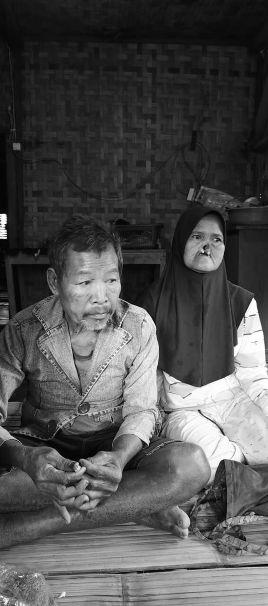 wasitligatarkam's tweet photo. Miris! pasangan tak memiliki buah hati sering diledek, cuma ngangon domba orang lain, Mak Pipin lagi nyari uang buat berobat suaminya

Sejak kecil punya fisik yang tak sempurna hingga pernah dibully 😢 https://t.co/rVaFmgn9rx