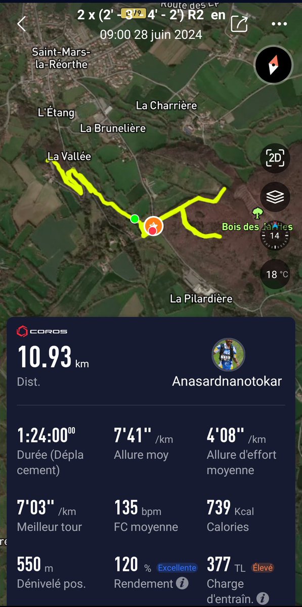 Jackanasardnan1's tweet photo. 👋#Runners. Spécifique Endurance Côte.Echauffement 30'👉 2 × (2'-3'-4'-2' Récup Temps d'effort) et 2' Récup entre Séries.Bye.#PobarBodyChallenge #RunningWithTomiSole @ComuniRunners #TrailAddict
Take a look at Strava : https://t.co/HbiSDo9XRD https://t.co/vWiZsLIGeQ