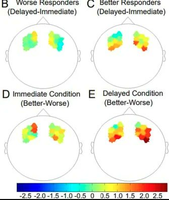 CionekJackson's tweet photo. Value-based sequential decision-making in healthy older adults
@congressobrain
#Brain2024
#OHBM2024
#FeSBE2024
#SBNeC2024
#SfN2024
https://t.co/w4YoZk782t https://t.co/n1yE1J1no1