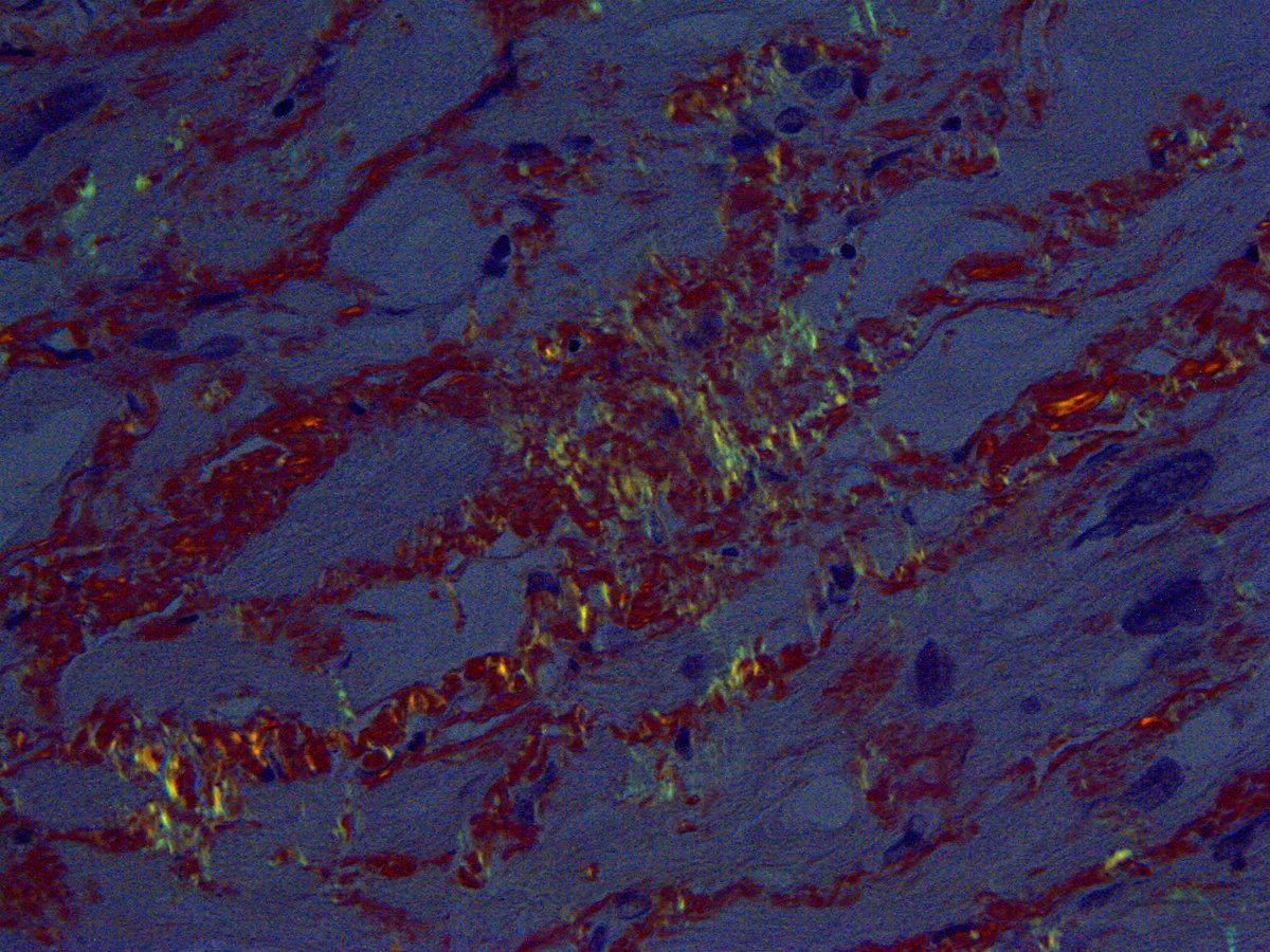 Pathology Walker@Auto Tweet Bot tweet media