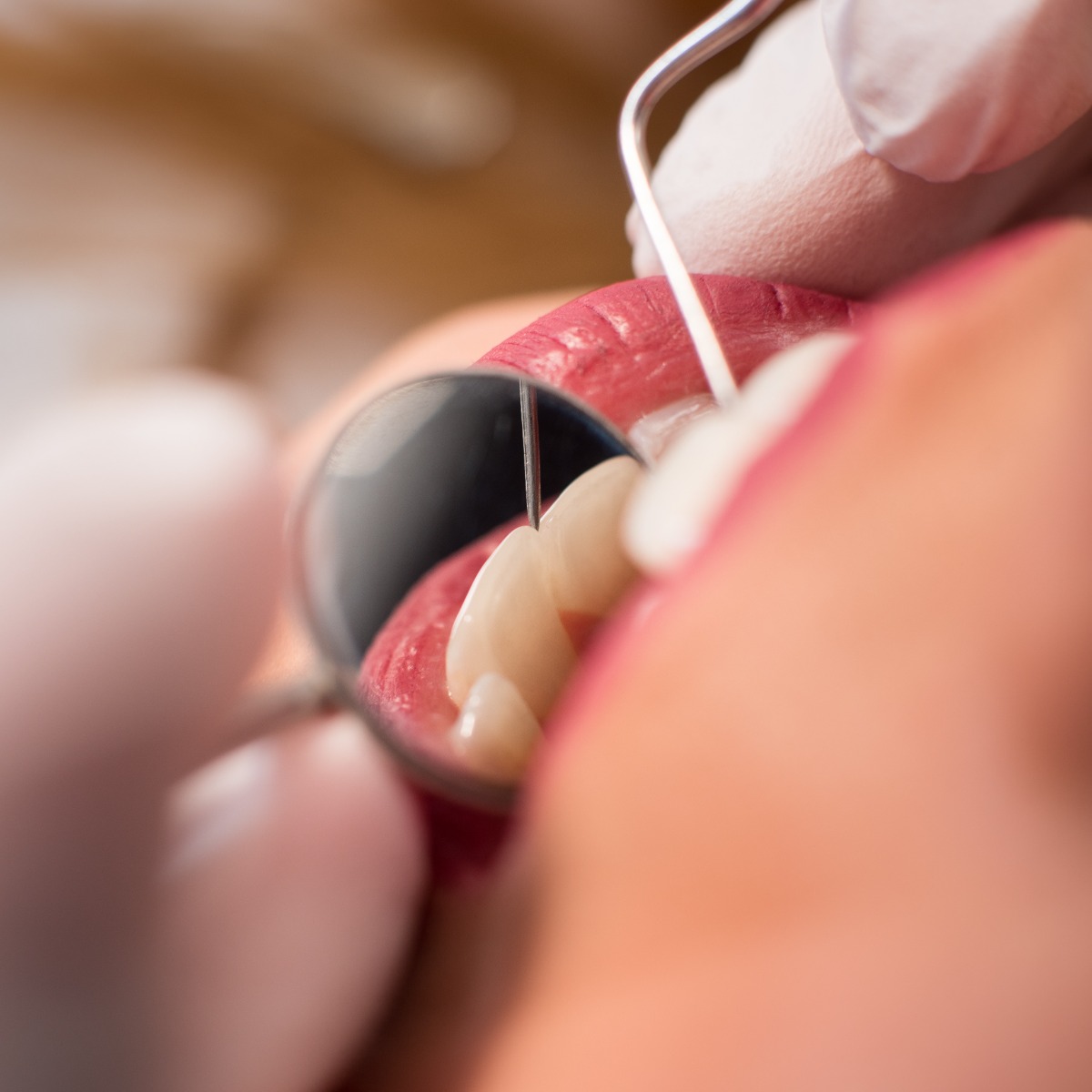 LindenGStevens's tweet photo. Dealing with a dental emergency? Beautiful Smiles by Linden G. Stevens DDS General Dentistry offers same-day emergency appointments to provide prompt relief and care when you need it most. Don't suffer in pain – contact us for immediate assistance! https://t.co/VPSeoAc7JG