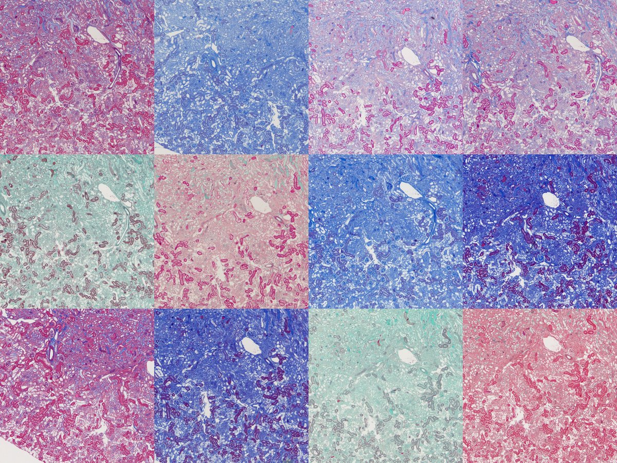 Lots of different things get called Masson's trichrome. Here's some of them.

(for testing purposes there's no haematoxylin so I guess technically it's Masson's dichrome atm)