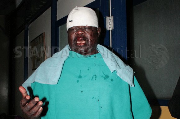 morris_ouko's tweet image. This is Okiya Omtata in 2012. Beaten and teeth removed in defence of the constitution. Since then, he has filed over 500 cases against the corrupt and other law violations. He lives a simple life, devoid of the usual opulence by politicians. 2027 is a year to give him a try