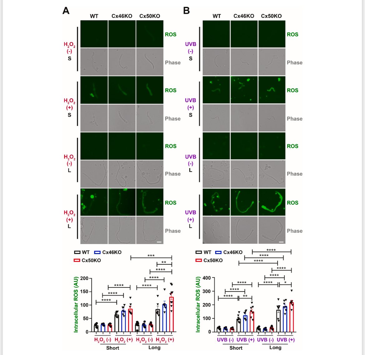 JeanJiangLab's tweet image. Good news from our lens group. A new published paper”Mechano-activated Connexin Hemichannels and Glutathione Transport Protect Lens Fiber Cells Against Oxidative Insults” in #RedoxBiology. Welcome to get some details for how Cx HCs regulate #oxidative #stress.