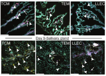 LabWaggoner's tweet photo. Circulating KLRG1+ memory T cells rapidly enter nonlymphoid tissues after viral infection and differentiate into resident memory @SciImmunology 
@HamiltonHartLab https://t.co/PlbC8d8ICi https://t.co/enmUnFEzFI
